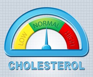 Cholesterol norma